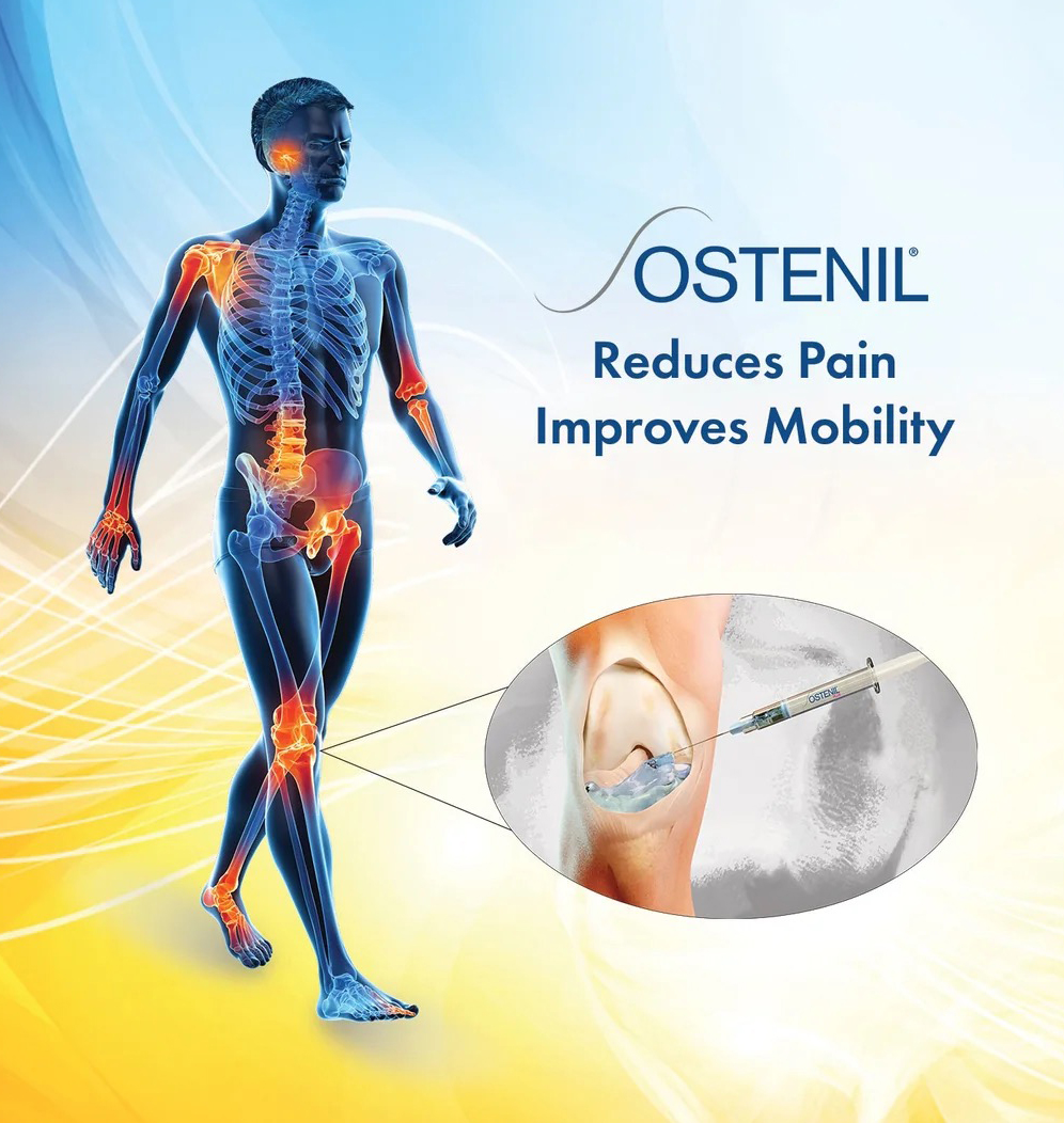 Ostenil